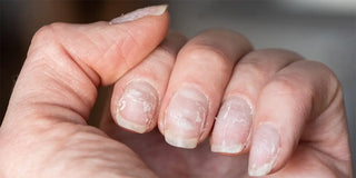 What Are Those White Spots on Your Nails