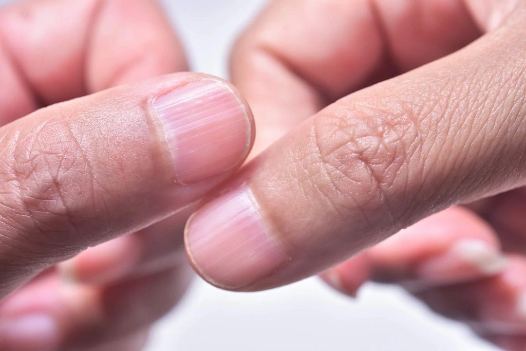 All about Ridges in Fingernails: Types, Causes, Symptoms and Precaution - DTK Nail Supply
