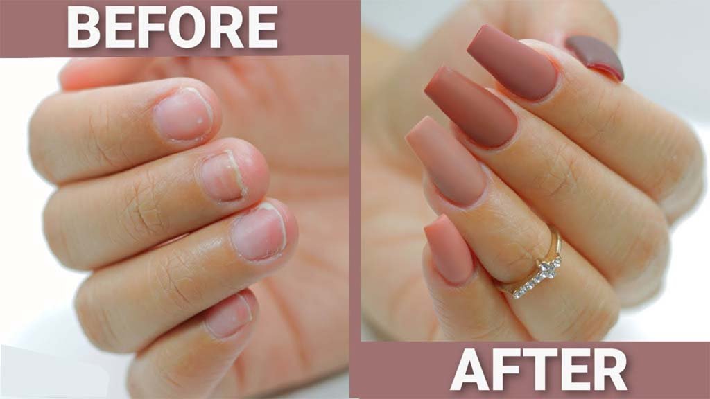 Can You Get Acrylics on Bitten Nails? - DTK Nail Supply