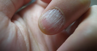 Three Ways How to Fix a Vertical Split Nail