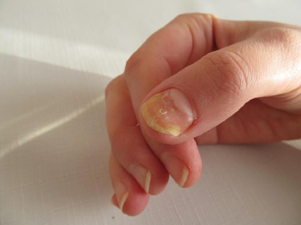 Dermatologist Explains 10 Possible Reasons Why Your Nails Are Brittle and Dry - DTK Nail Supply
