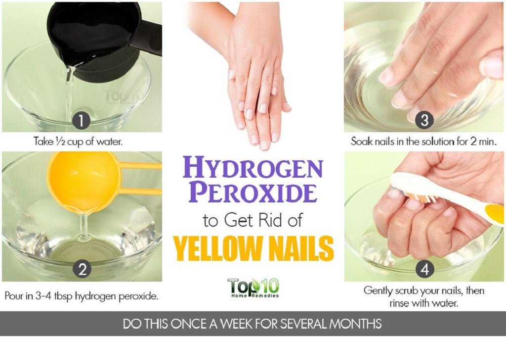 The 10 Best Foolproof Ways to Get Rid of Yellow Nails 2025 - DTK Nail Supply