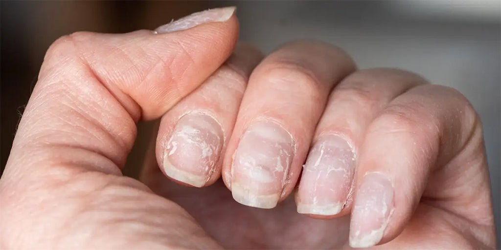 What Are Those White Spots on Your Nails? - DTK Nail Supply