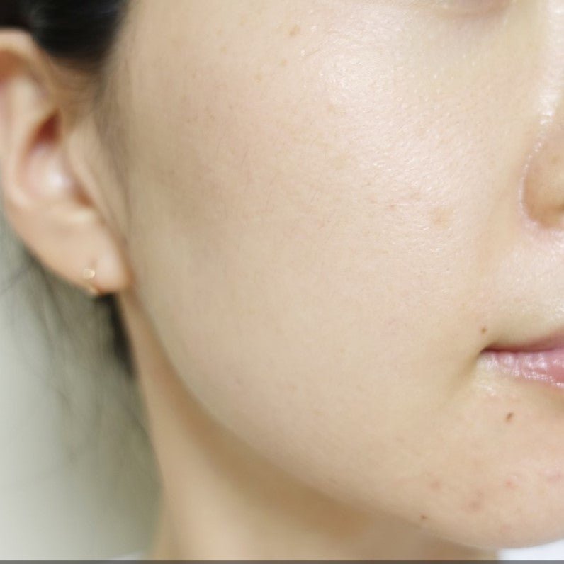 Dermafix Original Humal Collagen Program - DTK Nail Supply